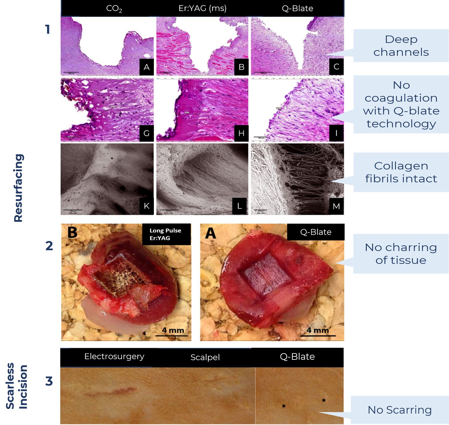 Histology comparing CO₂, Er:YAG and picosecond infrared laser ablation, and scar formation after electrosurgery, scalpel and PIRL incisions